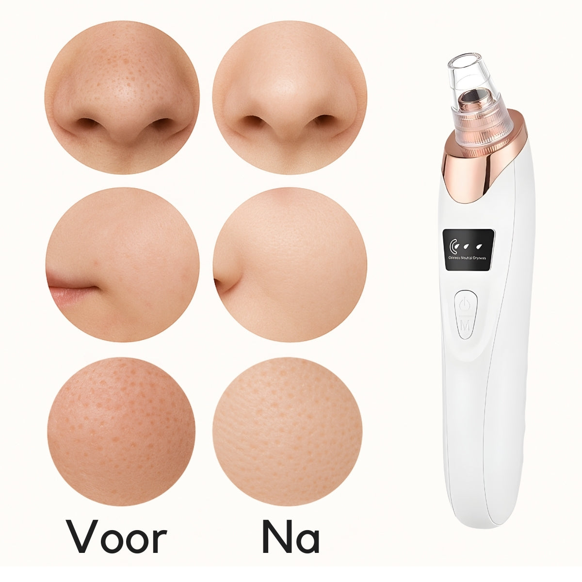 Zichtbaar schonere poriën
