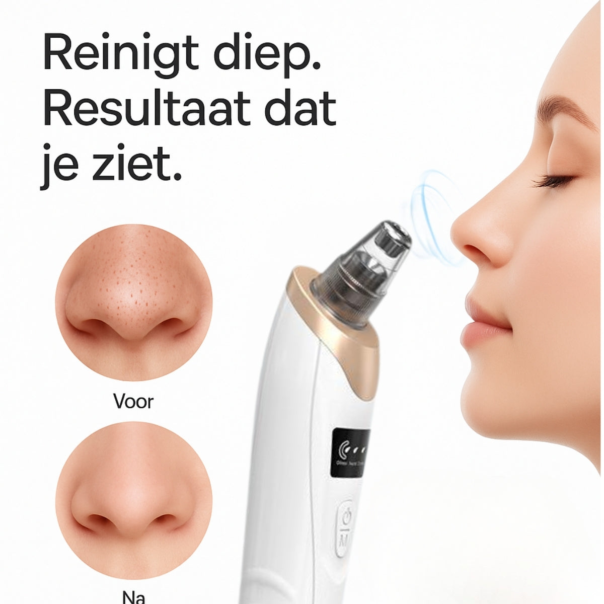 Blackhead remover poriënreiniger