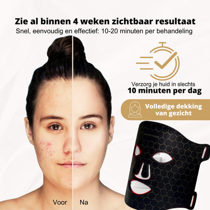 LED-masker lichttherapie (7 kleuren)