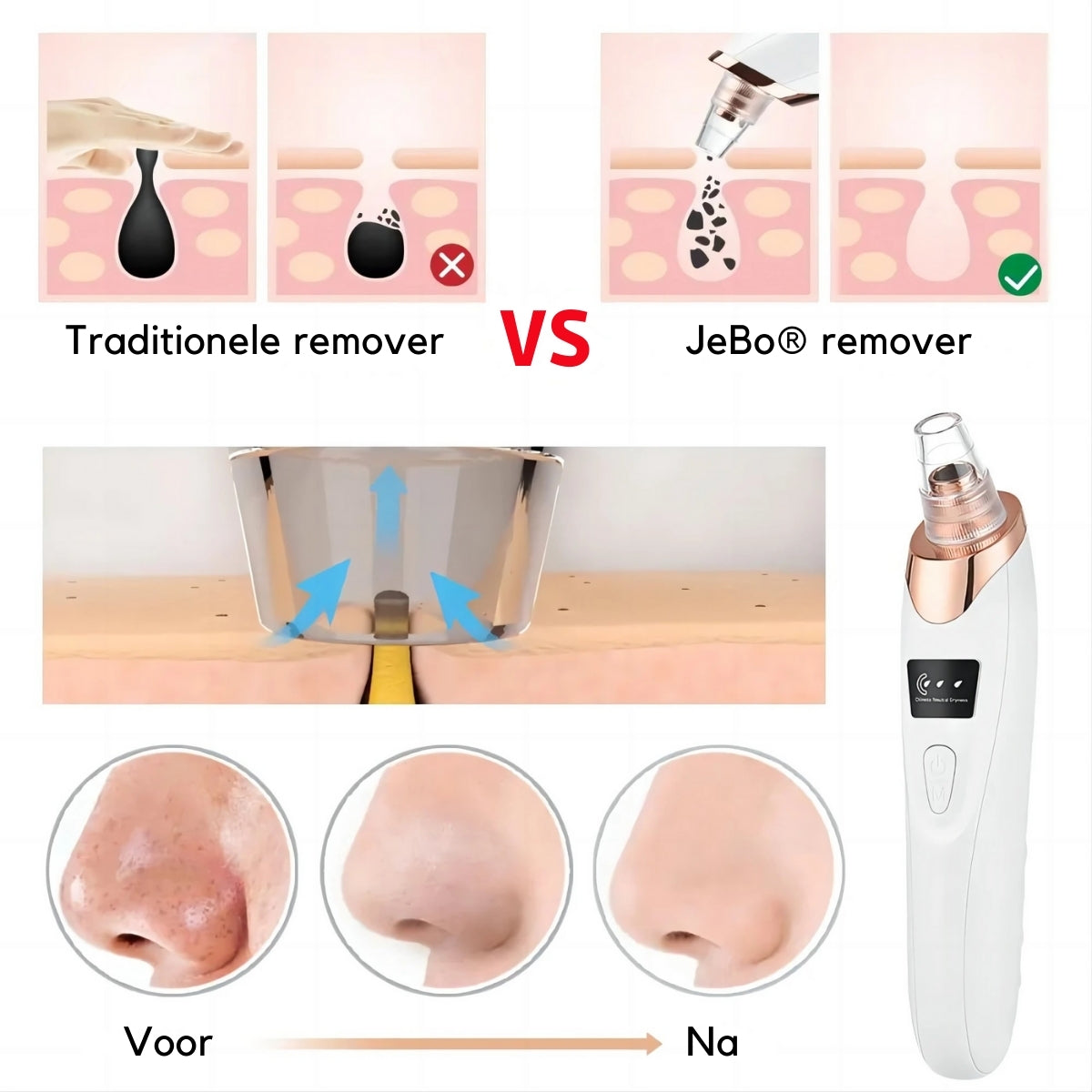 Blackhead remover poriënreiniger