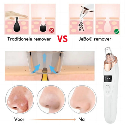 Blackhead remover poriënreiniger