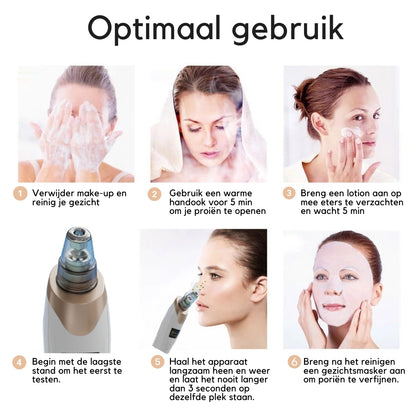 Blackhead remover poriënreiniger